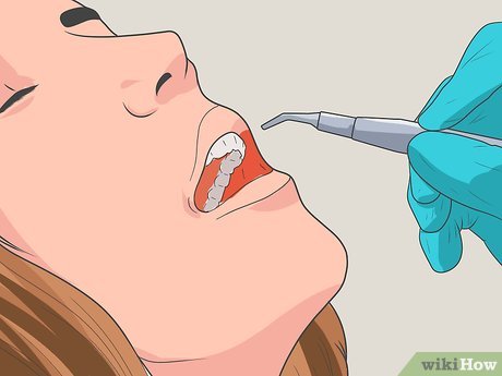 Step 4 Поймите, что стоматологические. 
